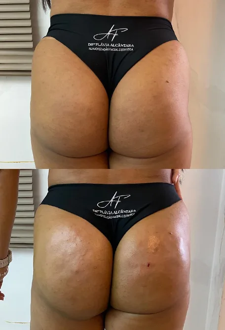 BUNDA 2